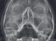 Центр диагностики челюстно–лицевой области Пикассо на улице Юных Ленинцев Фото 8 на сайте Kuzminki.su